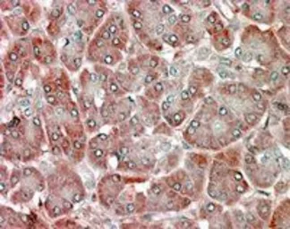 Anti-RBP1 antibody, C-term used in IHC (Paraffin sections) (IHC-P). GTX89561