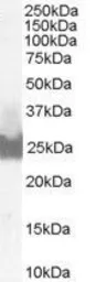 Anti-Bid antibody, C-term used in Western Blot (WB). GTX89562