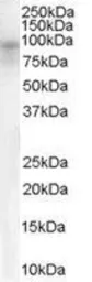 Anti-DPP10 antibody, Internal used in Western Blot (WB). GTX89564