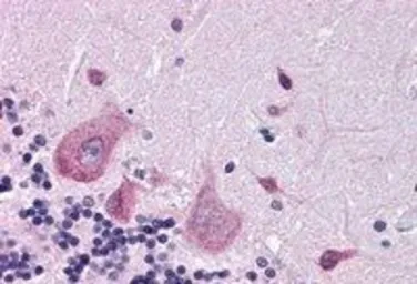 Anti-DPP10 antibody, Internal used in IHC (Paraffin sections) (IHC-P). GTX89564