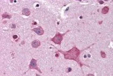 Anti-DPP10 antibody, Internal used in IHC (Paraffin sections) (IHC-P). GTX89564