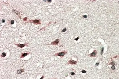 Anti-DYX1C1 (Isoform a) antibody, C-term used in IHC (Paraffin sections) (IHC-P). GTX89566
