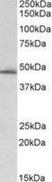 Anti-PAI-1 antibody, Internal used in Western Blot (WB). GTX89568