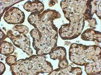 Anti-PAI-1 antibody, Internal used in IHC (Paraffin sections) (IHC-P). GTX89568