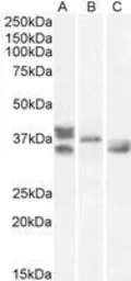 Anti-Renalase (aa 224 to 233) antibody, Internal used in Western Blot (WB). GTX89570