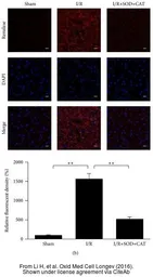 Anti-Renalase (aa 224 to 233) antibody, Internal used in IHC (Frozen sections) (IHC-Fr). GTX89570