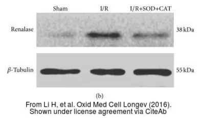 Anti-Renalase (aa 224 to 233) antibody, Internal used in Western Blot (WB). GTX89570