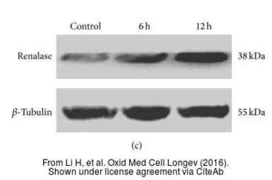 Anti-Renalase (aa 224 to 233) antibody, Internal used in Western Blot (WB). GTX89570