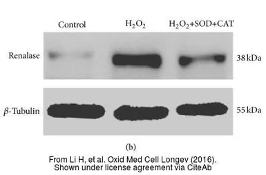Anti-Renalase (aa 224 to 233) antibody, Internal used in Western Blot (WB). GTX89570