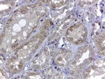 Anti-Renalase (aa 224 to 233) antibody, Internal used in IHC (Paraffin sections) (IHC-P). GTX89570
