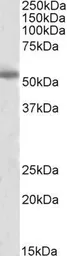 Anti-Tyrosine Hydroxylase antibody, C-term used in Western Blot (WB). GTX89578