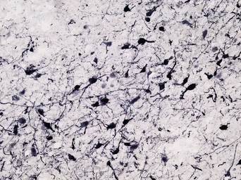 Anti-Tyrosine Hydroxylase antibody, C-term used in IHC (Frozen sections) (IHC-Fr). GTX89578