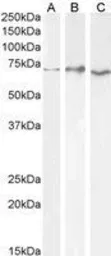 Anti-AChE antibody, C-term used in Western Blot (WB). GTX89580