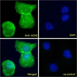 Anti-AChE antibody, C-term used in Immunocytochemistry/ Immunofluorescence (ICC/IF). GTX89580