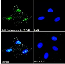 Anti-Nucleophosmin antibody, C-term used in Immunocytochemistry/ Immunofluorescence (ICC/IF). GTX89581