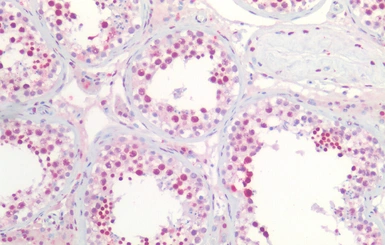 Anti-Nucleophosmin antibody, C-term used in IHC (Paraffin sections) (IHC-P). GTX89581