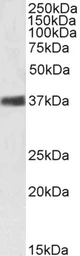 Anti-Nucleophosmin antibody, C-term used in Western Blot (WB). GTX89581