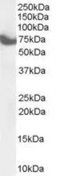 Anti-ZDHHC17 antibody, C-term used in Western Blot (WB). GTX89582