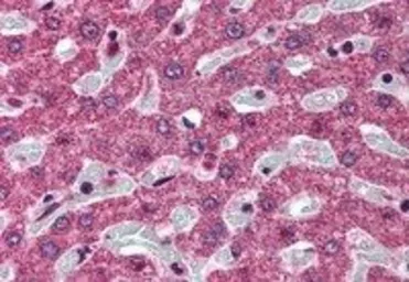Anti-SRD5A1 antibody, N-term used in IHC (Paraffin sections) (IHC-P). GTX89584