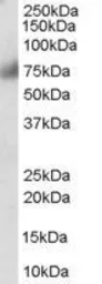 Anti-FGFR1 antibody, C-term used in Western Blot (WB). GTX89588