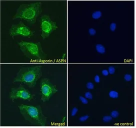 Anti-Asporin antibody, Internal used in Immunocytochemistry/ Immunofluorescence (ICC/IF). GTX89589