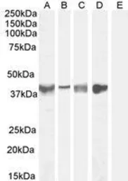 Anti-Asporin antibody, Internal used in Western Blot (WB). GTX89589