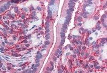 Anti-Cytochrome b reductase 1 antibody, C-term used in IHC (Paraffin sections) (IHC-P). GTX89592