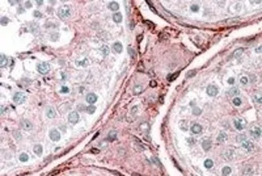Anti-Cytochrome b reductase 1 antibody, C-term used in IHC (Paraffin sections) (IHC-P). GTX89592