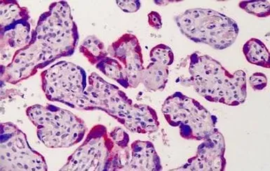 Anti-ADAM12 antibody, N-term used in IHC (Paraffin sections) (IHC-P). GTX89596