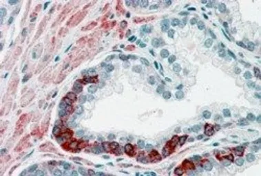 Anti-ADAM12 antibody, N-term used in IHC (Paraffin sections) (IHC-P). GTX89596