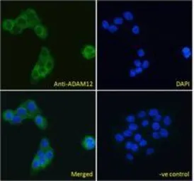 Anti-ADAM12 antibody, N-term used in Immunocytochemistry/ Immunofluorescence (ICC/IF). GTX89596