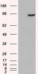 Anti-PDE5A antibody, C-term used in Western Blot (WB). GTX89598