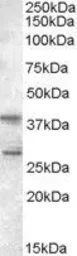 Anti-SCAP2 antibody, C-term used in Western Blot (WB). GTX89599