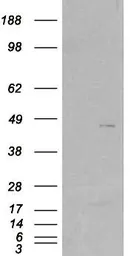 Anti-SCAP2 antibody, C-term used in Western Blot (WB). GTX89599