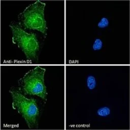Anti-Plexin D1 antibody, Internal used in Immunocytochemistry/ Immunofluorescence (ICC/IF). GTX89601