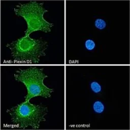 Anti-Plexin D1 antibody, Internal used in Immunocytochemistry/ Immunofluorescence (ICC/IF). GTX89601