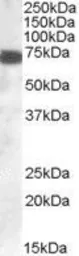 Anti-ZDHHC13 antibody, C-term used in Western Blot (WB). GTX89603