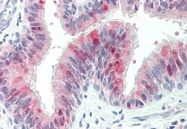 Anti-ZDHHC13 antibody, C-term used in IHC (Paraffin sections) (IHC-P). GTX89603