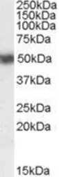 Anti-Retinoic Acid Receptor alpha antibody, C-term used in Western Blot (WB). GTX89607