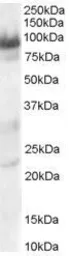 Anti-TRAK1 antibody, C-term used in Western Blot (WB). GTX89610