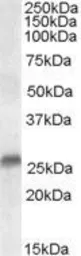 Anti-SRD5A2 antibody, N-term used in Western Blot (WB). GTX89611