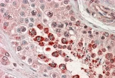 Anti-XAGE1 (Isoform 1d) / GAGED2 antibody, C-term used in IHC (Paraffin sections) (IHC-P). GTX89612