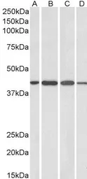 Anti-Centaurin alpha 1 antibody, C-term used in Western Blot (WB). GTX89614