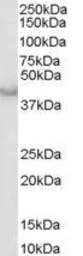 Anti-Caspase 4 antibody, Internal used in Western Blot (WB). GTX89618