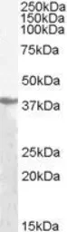 Anti-Alcohol Dehydrogenase antibody, N-term used in Western Blot (WB). GTX89624