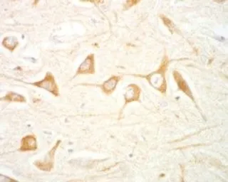 Anti-LRRK2 (near C Terminus) antibody, Internal used in IHC (Paraffin sections) (IHC-P). GTX89626