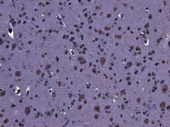 Anti-LRRK2 (near C Terminus) antibody, Internal used in IHC (Paraffin sections) (IHC-P). GTX89626