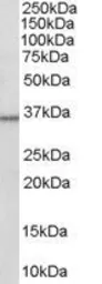 Anti-HSD11B1 antibody, C-term used in Western Blot (WB). GTX89627