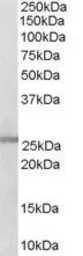 Anti-GSTM1 / GSTM2 antibody, C-term used in Western Blot (WB). GTX89628