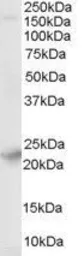 Anti-Synaptogyrin 4 antibody, N-term used in Western Blot (WB). GTX89630